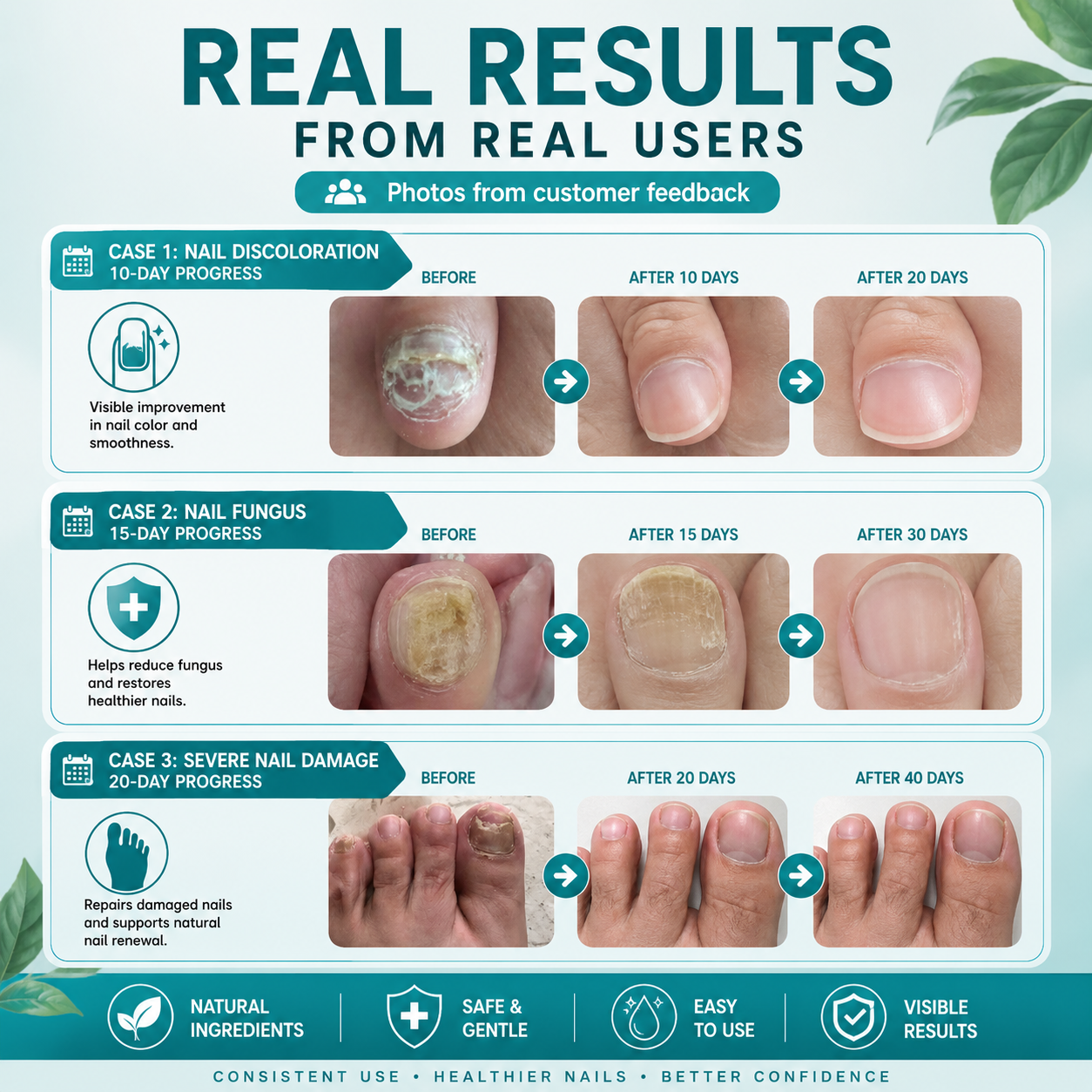Plant-Based Nail Renewal Patch | Healthy-Looking Nails | Onychomycosis Treatment