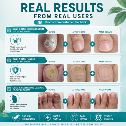 Plant-Based Nail Renewal Patch | Healthy-Looking Nails | Onychomycosis Treatment