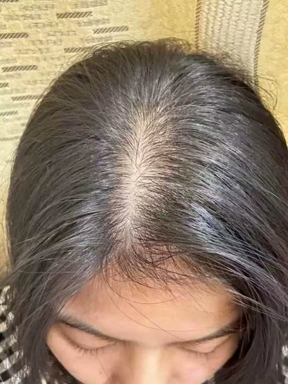Hair Growth Scalp Serum | Botanical Hair Activating Essence | MEMORA